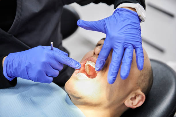 Best Emergency Tooth Extraction in Roselle, NJ